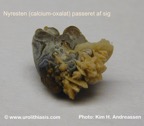 117c-kidney-stone_nyresten-calciumoxalate-spontan-Kim-Hovgaard-Andreassen