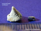 015-kidney-stone_nyresten-carbonate-apatite-URSL-Kim-Hovgaard-Andreassen